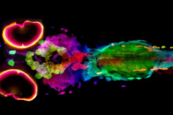 An image of a 5-day-old zebrafish with different colors throughout the zebrafish assigned based on the depth of the melanin in cells within the sample from top to bottom.