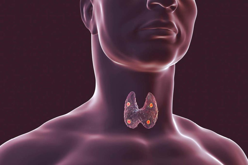 该图像显示了甲状腺和位于甲状腺后面的四个甲状旁腺。来源:盖蒂图片社
